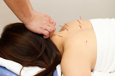 img-acupuncture.jpg